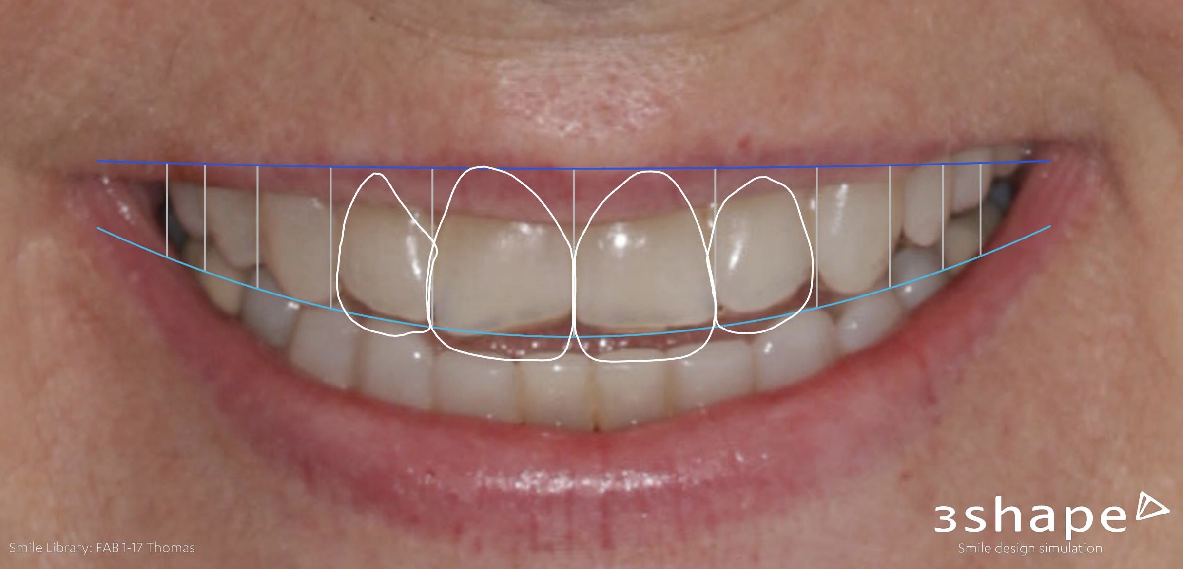 digital smiledesign